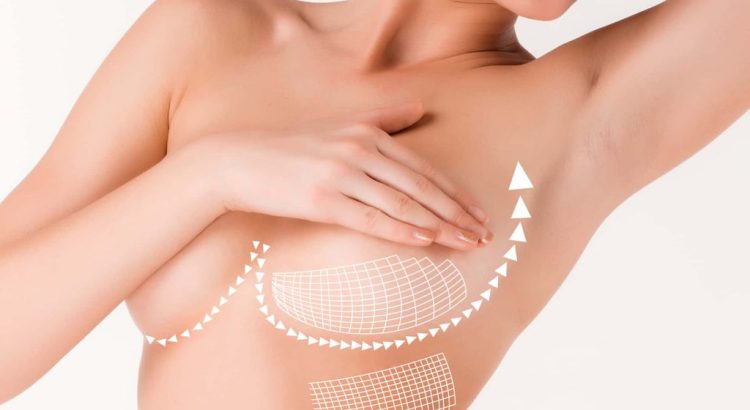 The Benefits of Breast Lift Surgery