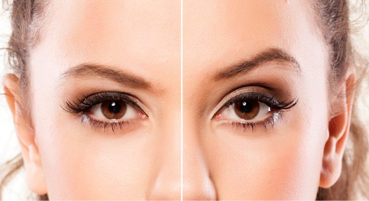 What Is a Eyebrow Lift? Types, Benefits, Risks