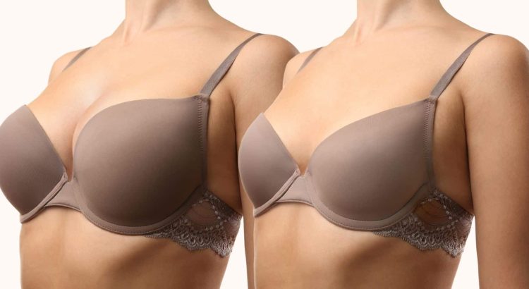 How is Breast Reduction Aesthetics Performed?