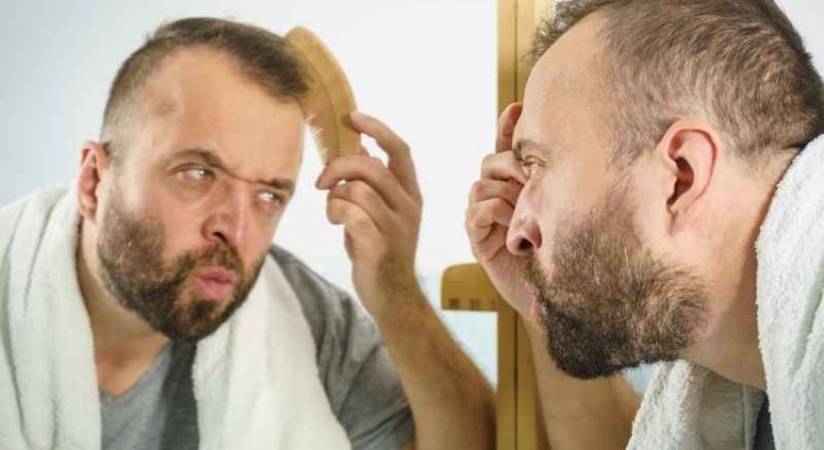 Hair Loss: Top 5 Effective Medicines