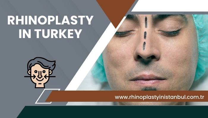 Rhinoplasty in TURKEY
