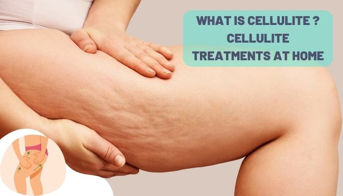 WHAT IS CELLULITE CELLULITE TREATMENTS AT HOME