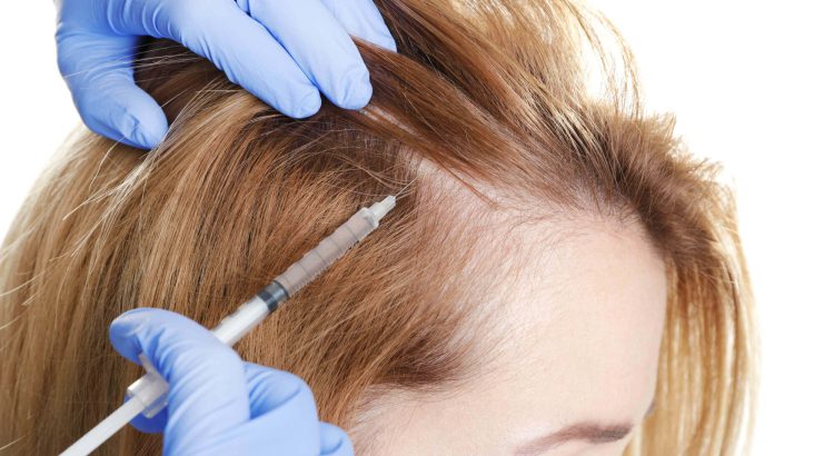 Advantages of Hair Mesotherapy