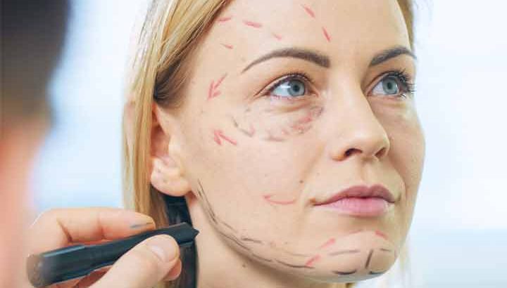 Facelift Surgery: What You Need to Know